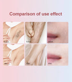 IPL Hair Removal Laser Permanent Body epilator Painless Device 999,999 Flashes