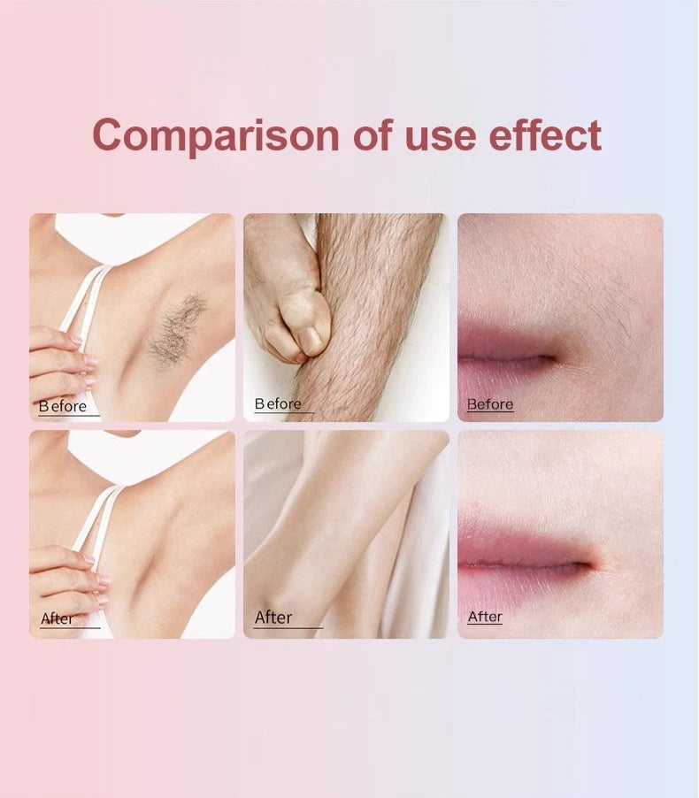 IPL Hair Removal Laser Permanent Body epilator Painless Device 999,999 Flashes